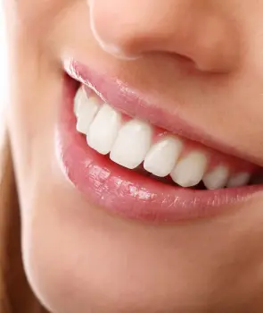 denti-bianchi-firenze